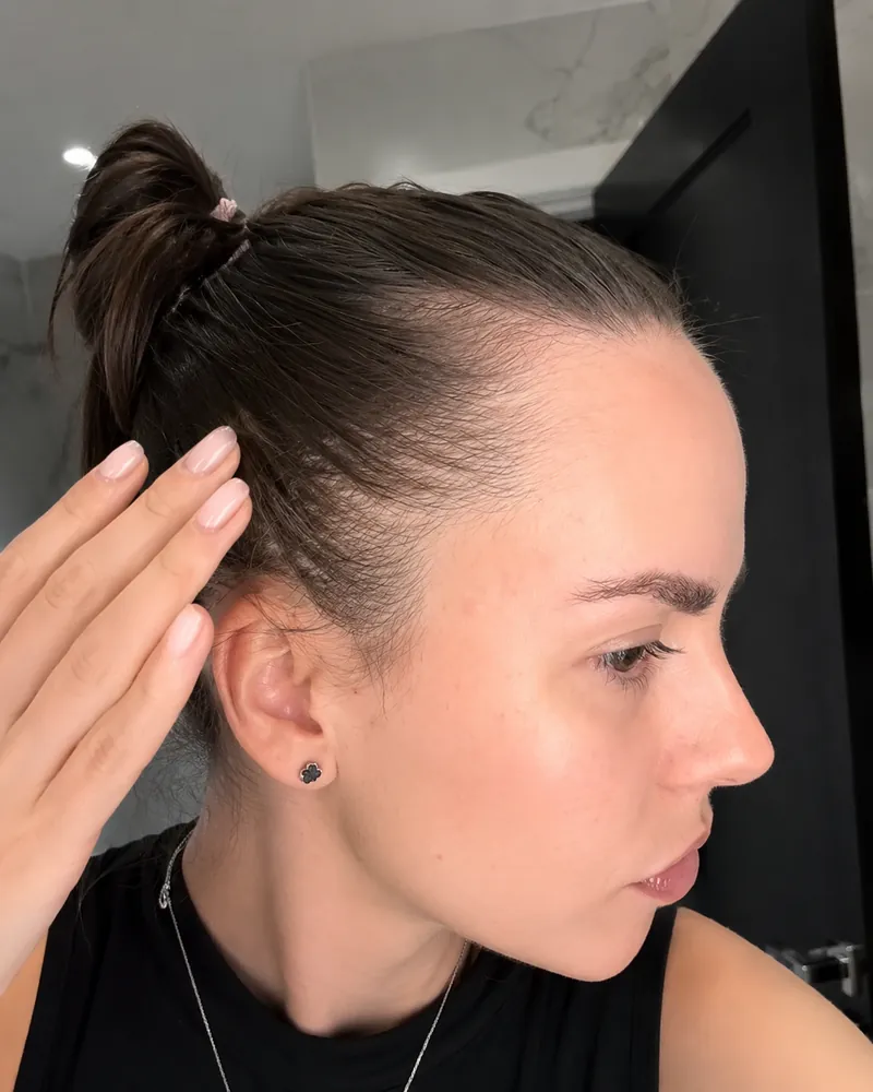 Ana, 37 anos, antes