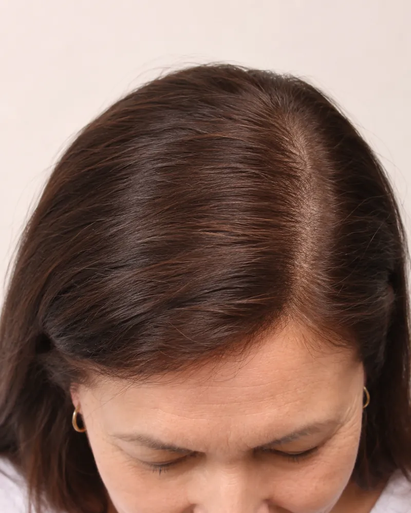 Patrícia, 47 anos, depois