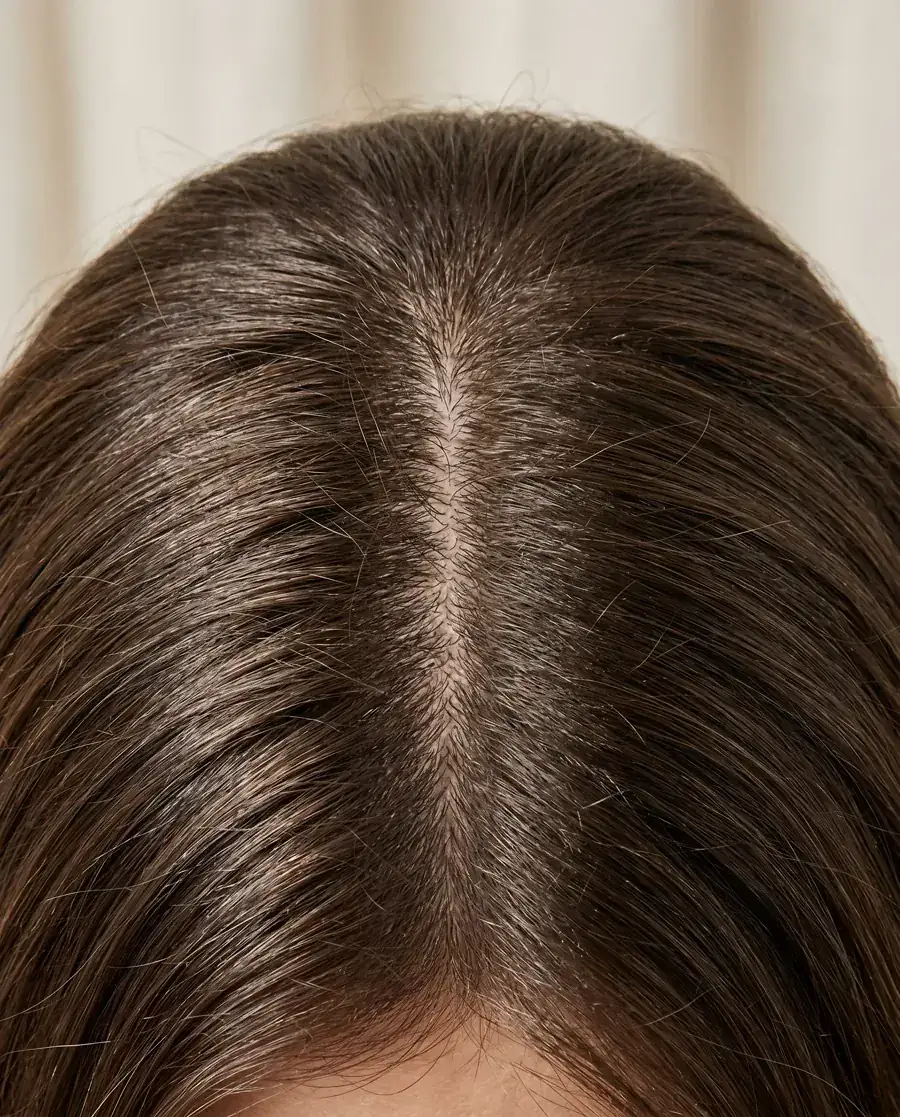 Marina, 42 anos, depois