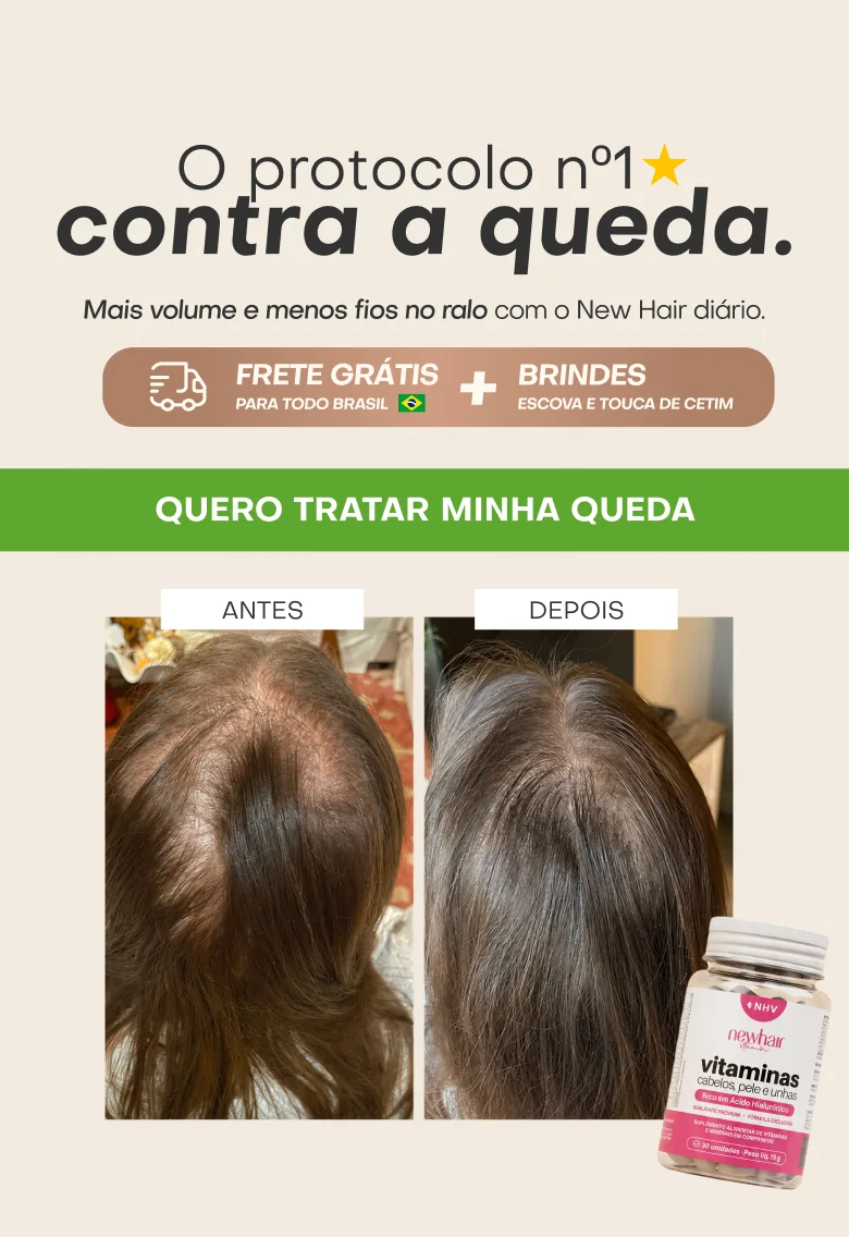 Protocolo New Hair — o melhor tratamento para queda de cabelo